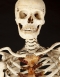 1920s real Human Skeleton ex medical study